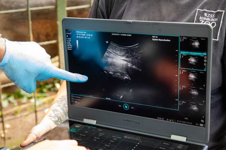 Gloria-ultrasound-scan-photo