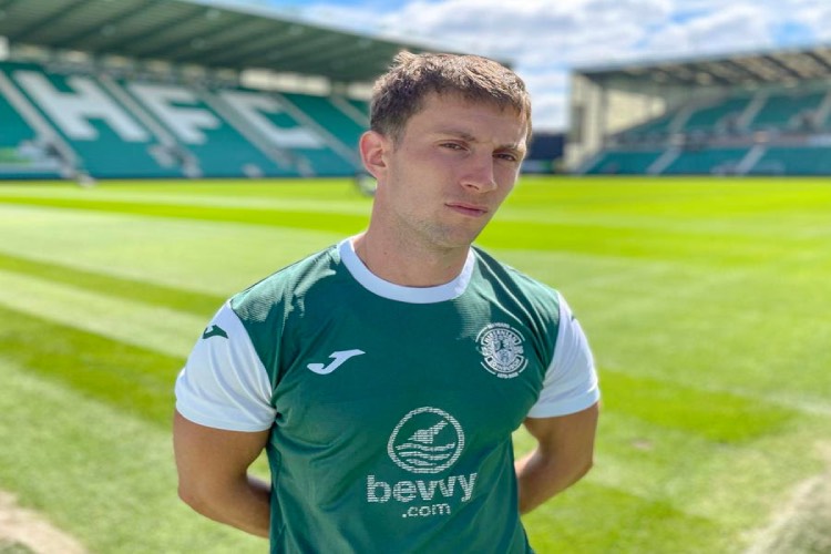 Hibs fringe show Alfie